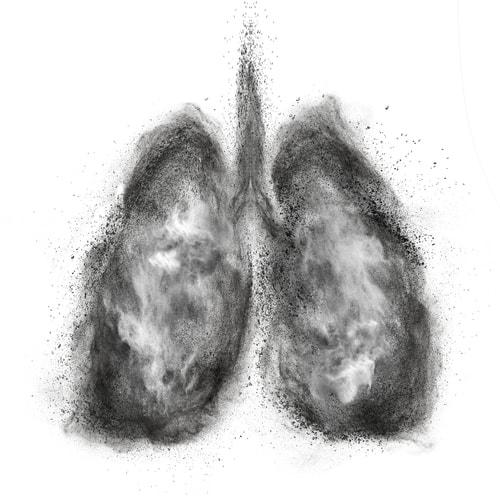 Lung Cancer - Hunter Valley Oncology
